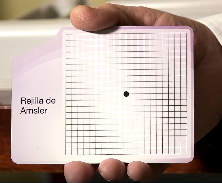 ¿Qué es la Rejilla de Amsler? Mucho por ver | Mayores UDP